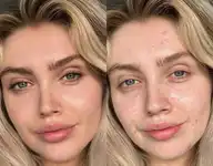 female skin before after